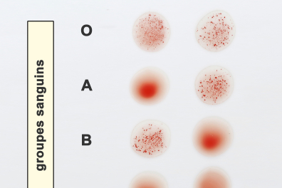 Détermination des groupes sanguins (à l'aide des globules rouges)